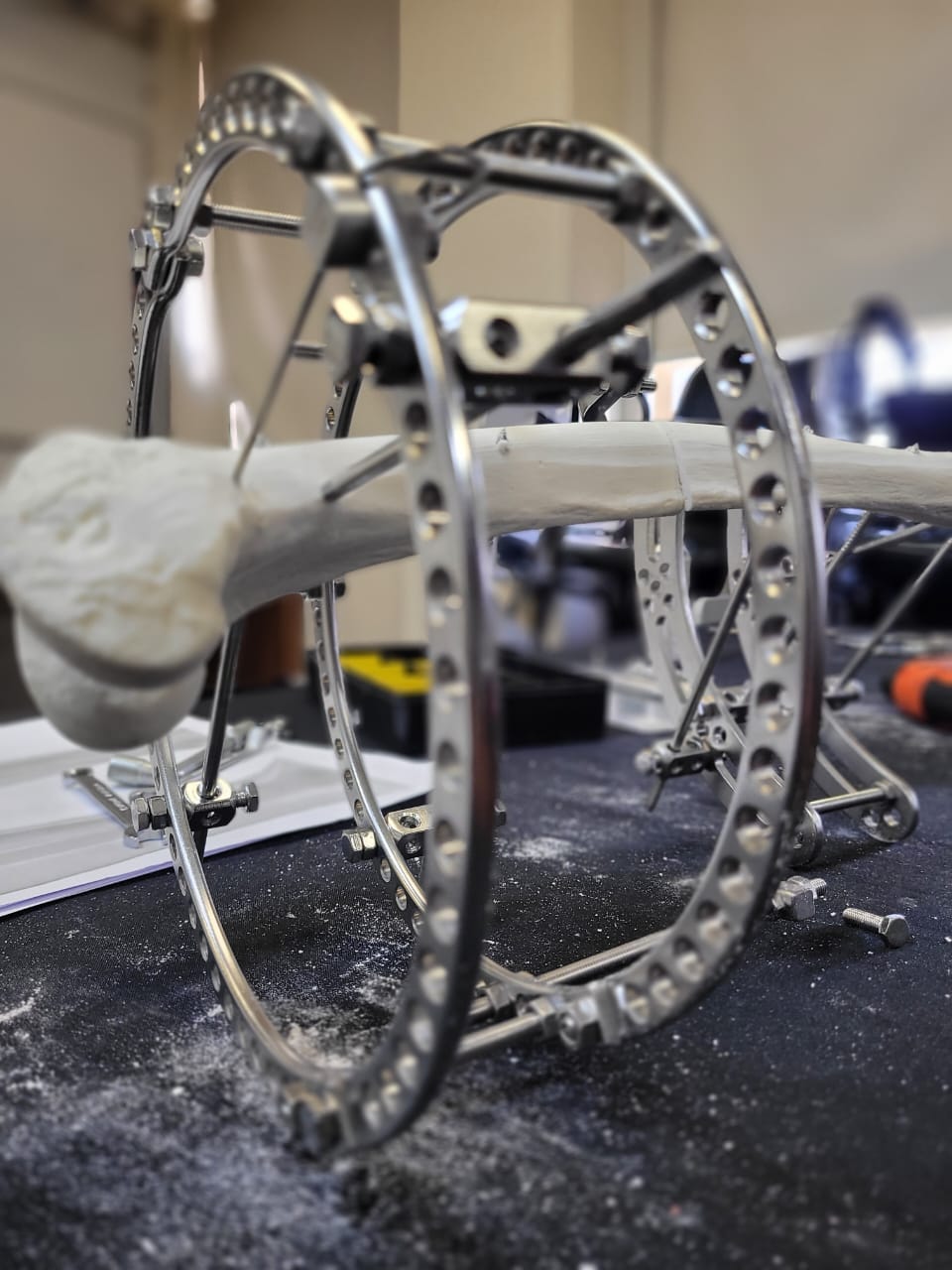 Princípios e conceitos Básicos Ilizarov no Trauma agudo