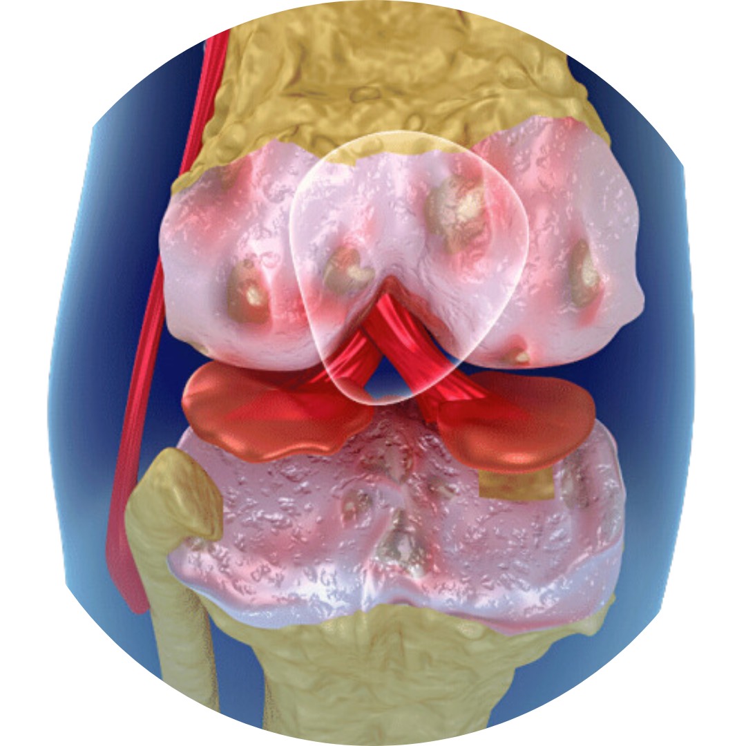 Curso Online Avançado de Revisão de LCA - 2023
